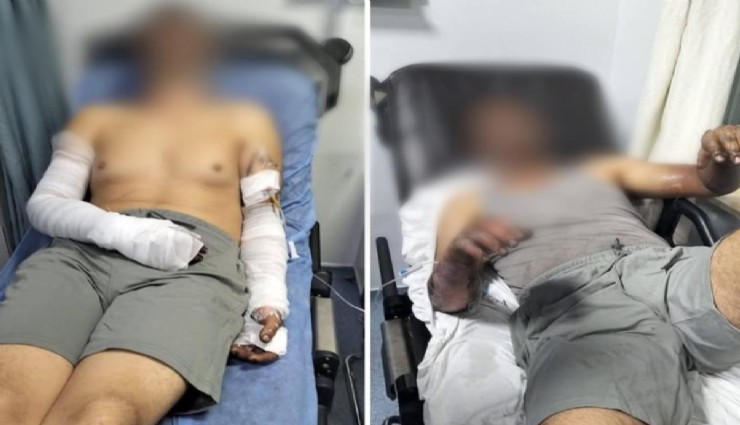 Sanayi sitesinde korkutan patlama: 2 kişi ölümden döndü