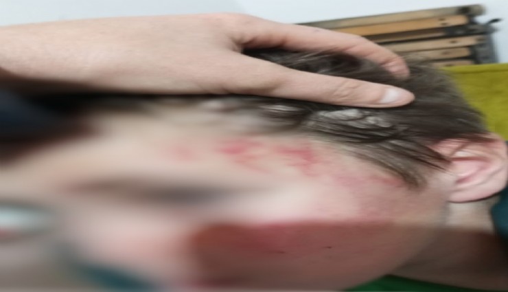 Otizmli çocuğu darbettiği iddia edilen şahsa hapis cezası