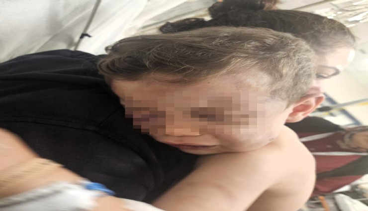 Vahşeti yaşayan 2 yaşındaki bebek hastanelik oldu