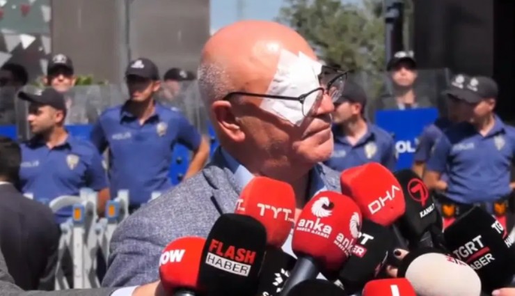 Mahmut Tanal görme kaybından kıl payı kurtuldu: 