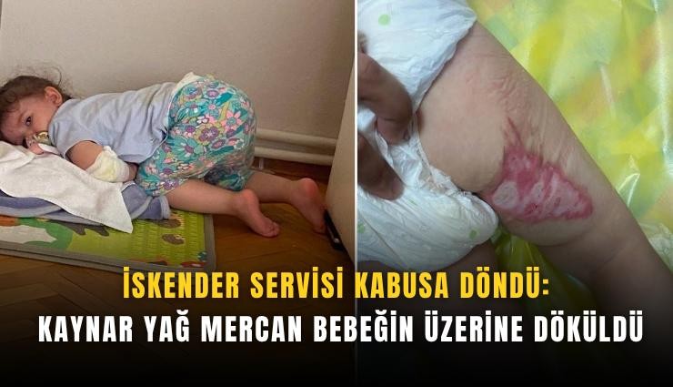 İskender servisi kabusa döndü: Kaynar yağ Mercan bebeğin üzerine döküldü